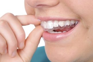 Doktoroo Dentist Invisalign