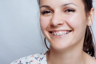 doktoroo braces